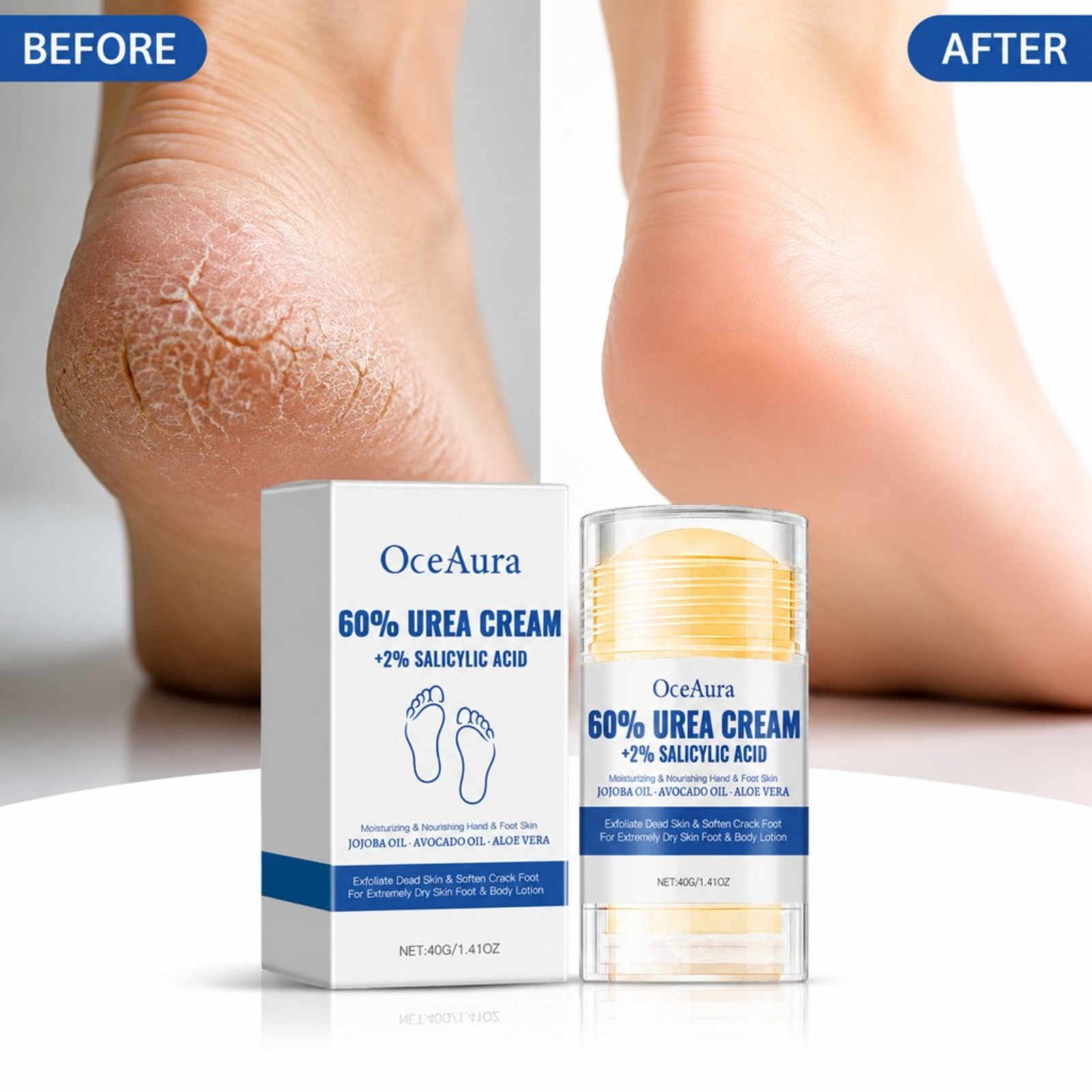 ครีมบำรุงเท้า 60% ยูเรีย แบบแท - Urea Foot Cream บทวิจารณ์และราคา