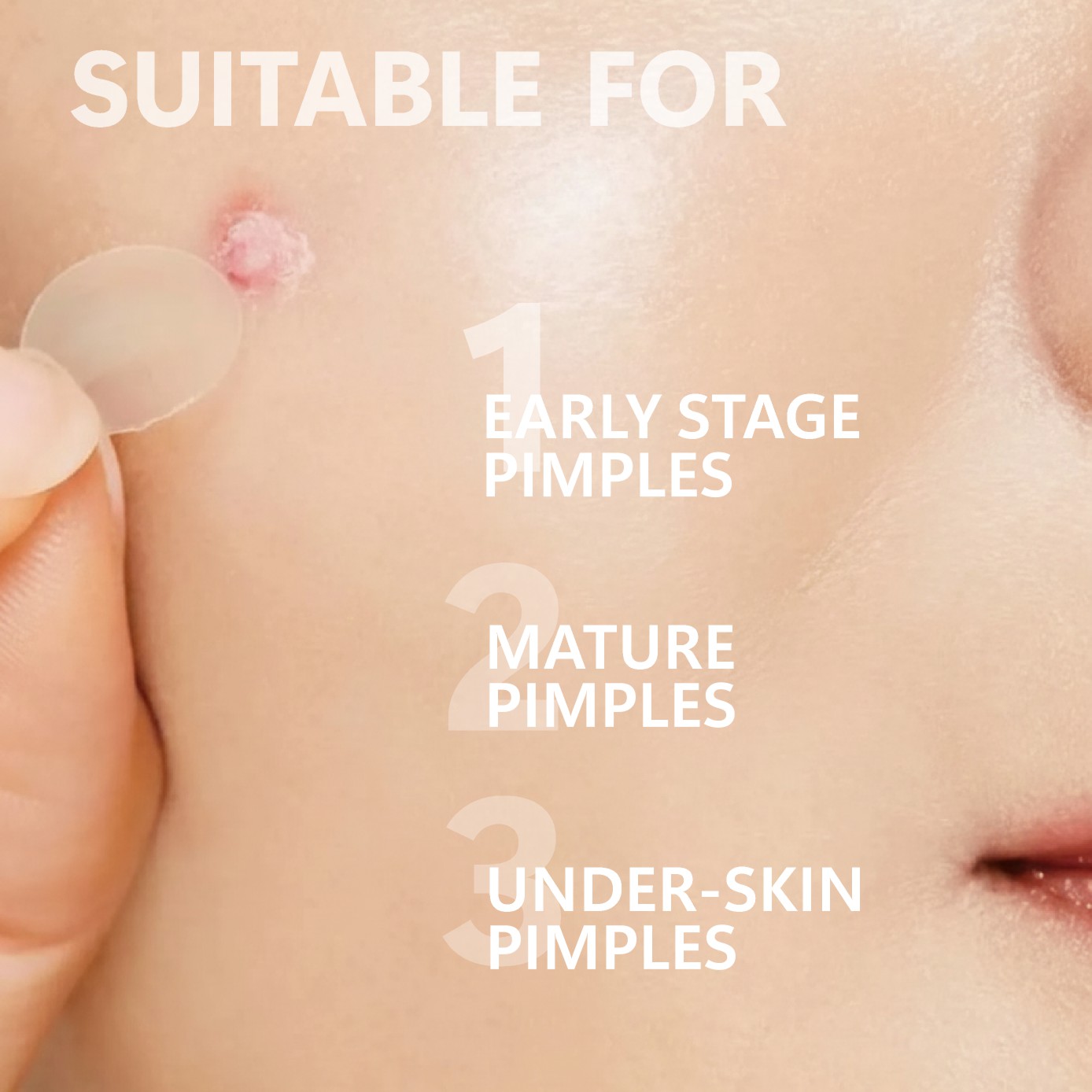 แผ่นแปะสิวไมโครนีดเดิล (24 แพ็ - Face Moisturizer บทวิจารณ์และราคา