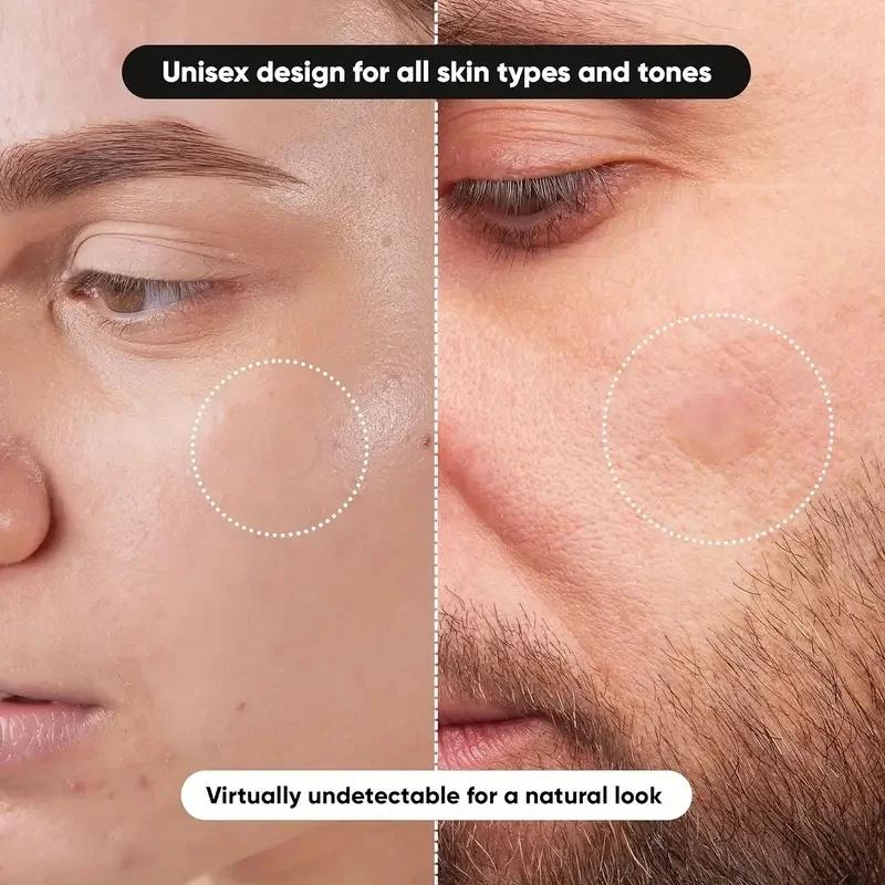 แผ่นแปะสิว 360 ชิ้น/กล่อง - ปร - Face Oil บทวิจารณ์และราคา