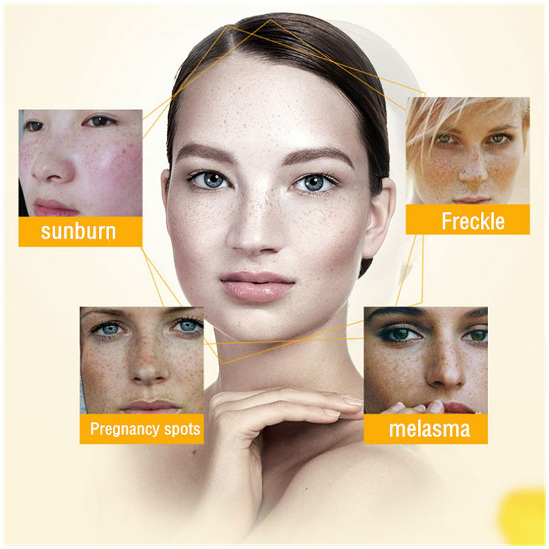Dimollaure Whitening Freckle C - Retinol Cream บทวิจารณ์และราคา