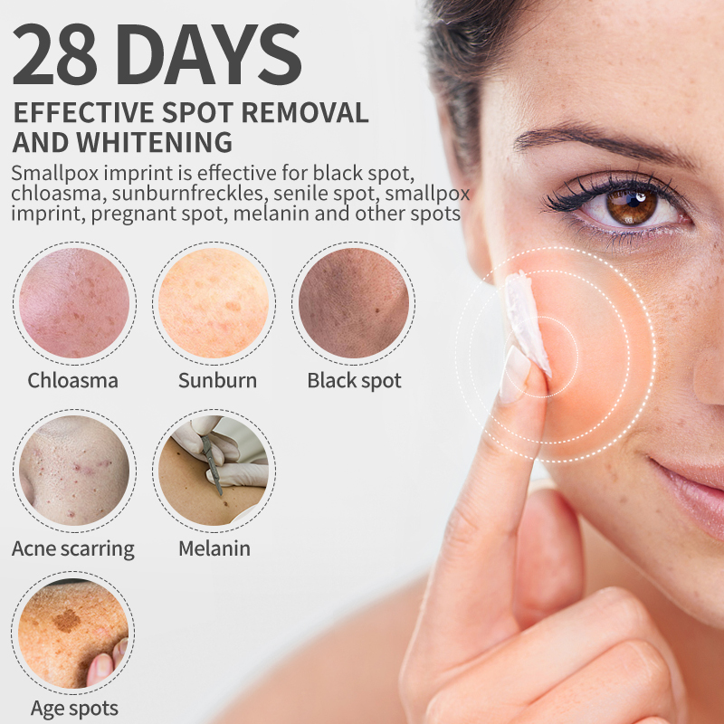Dimollaure Whitening Freckle C - Retinol Cream บทวิจารณ์และราคา