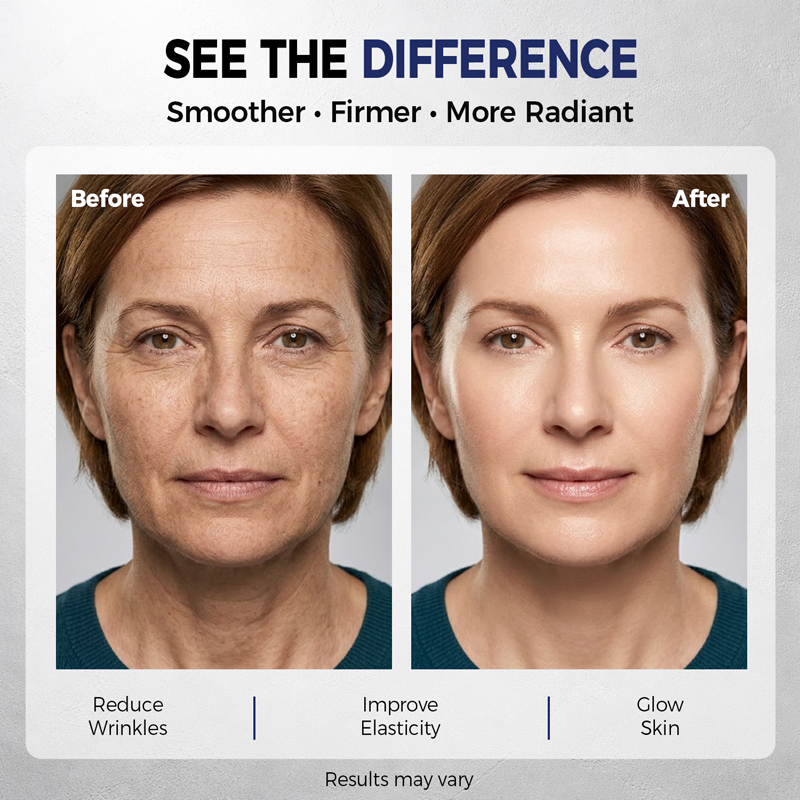 ครีมบำรุงผิวหน้าเรตินอลครีมลดร - Retinol Cream บทวิจารณ์และราคา