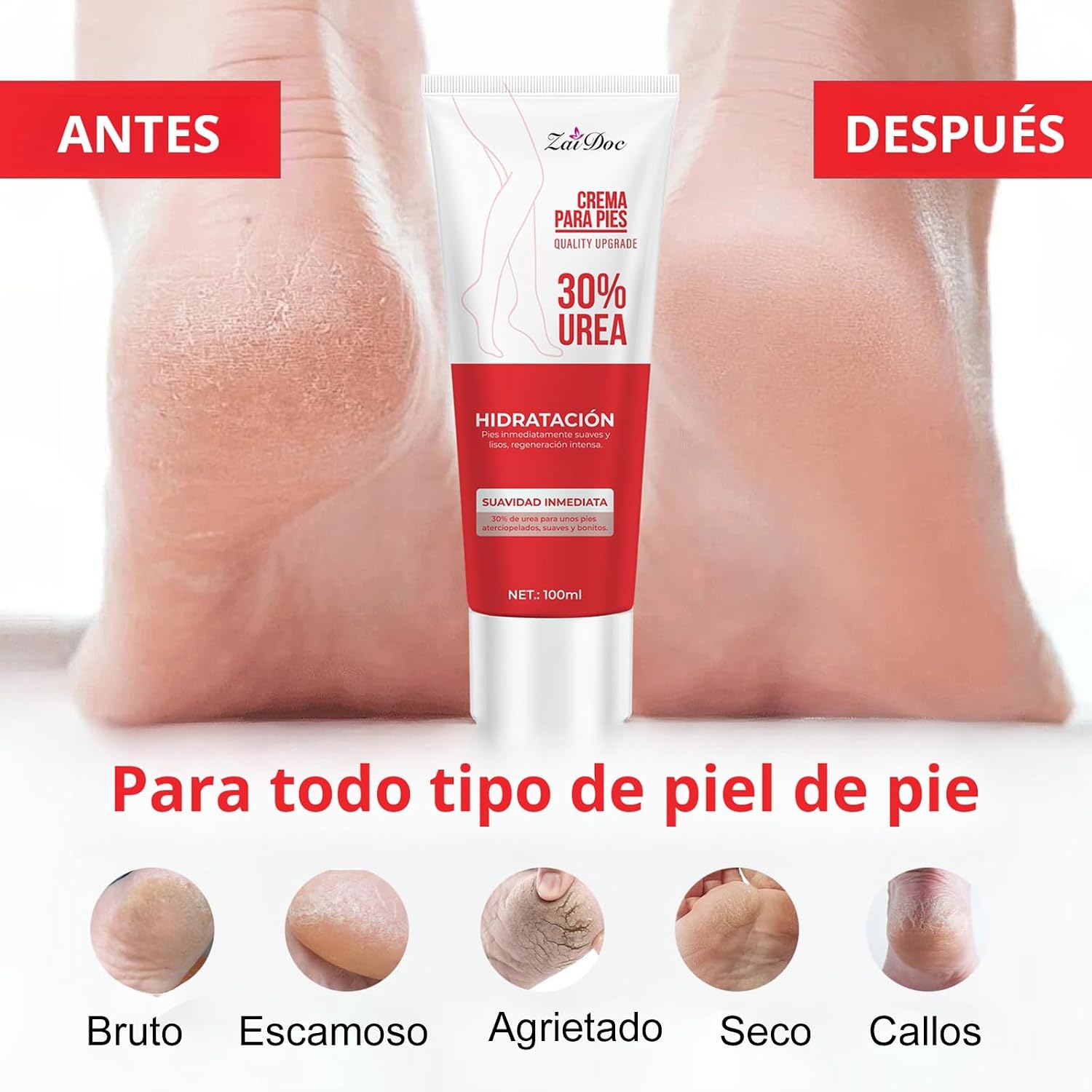 ZaiDoc ครีมบำรุงเท้า ยูเรีย 10 - Urea Foot Cream บทวิจารณ์และราคา