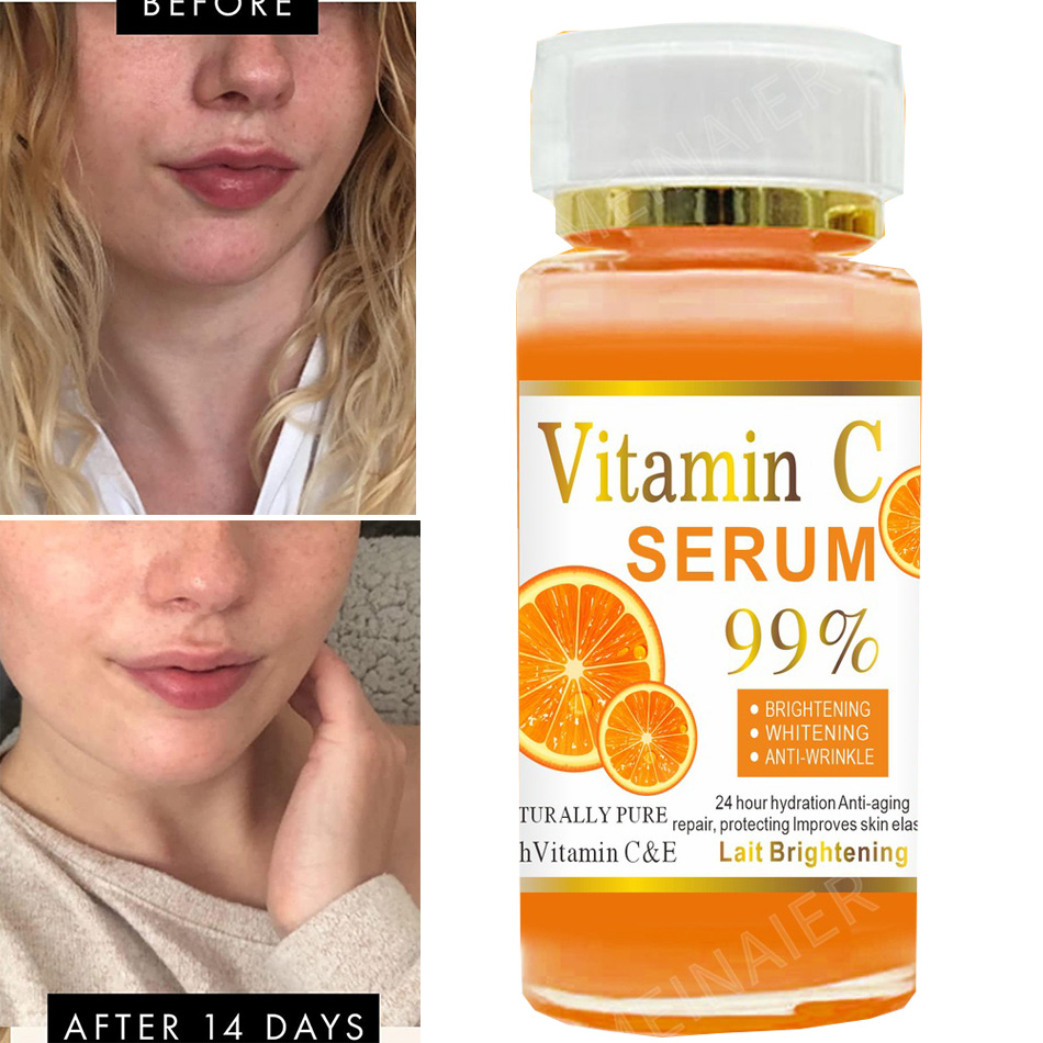 เซรั่มวิตามินซี120มล. ต่อต้านร - Vitamin C Serum บทวิจารณ์และราคา