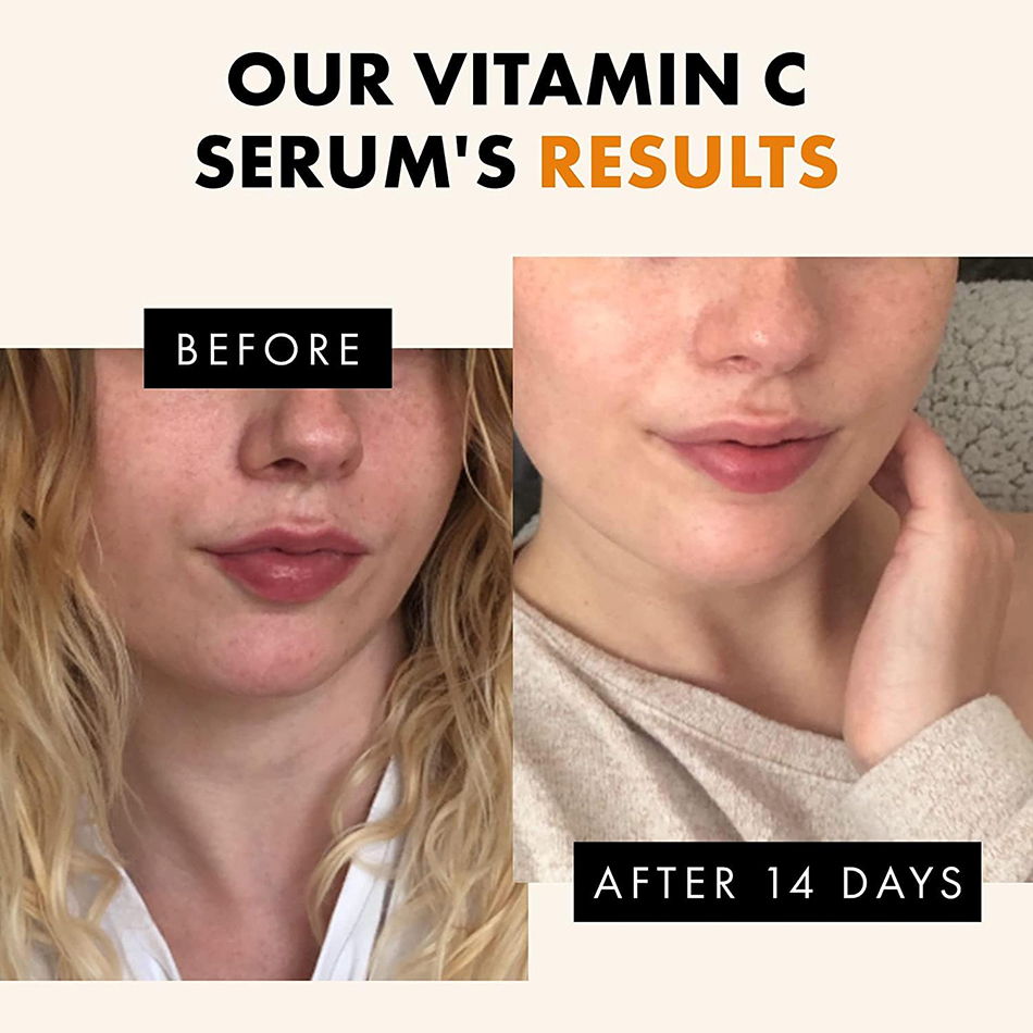 เซรั่มวิตามินซี120มล. ต่อต้านร - Vitamin C Serum บทวิจารณ์และราคา